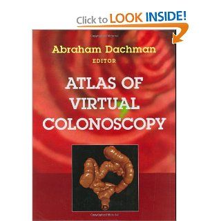 Atlas of Virtual Colonoscopy (9780387955117) Abraham H. Dachman, J.T. Ferrucci, J.H. Bond Books