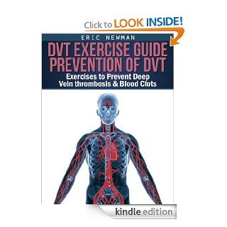DVT Exercise Guide   Prevention of DVT, Exercises to Help Prevent Deep Vein Thrombosis & Blood Clots eBook Eric Newman Kindle Store