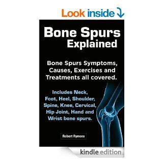 Bone Spurs explained. Bone Spurs Symptoms, Causes, Exercises and Treatments all covered. Includes Neck, Foot, Heel, Shoulder, Spine, Knee, Cervical, Hip Joint, Hand and Wrist bone spurs. eBook Robert Rymore Kindle Store