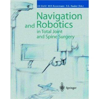Navigation and Robotics in Total Joint and Spine Surgery James B. Stiehl, Werner H. Konermann, Rolf G. Haaker 9783540029342 Books