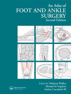 Atlas Foot and Ankle Surgery, Second Edition 9781841841953 Medicine & Health Science Books @