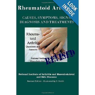 Rheumatoid Arthritis Causes, Symptoms, Signs, Diagnosis and Treatments   Revised Edition   Illustrated by S. Smith National Institute of Mental Health, S. Smith 9781469986685 Books