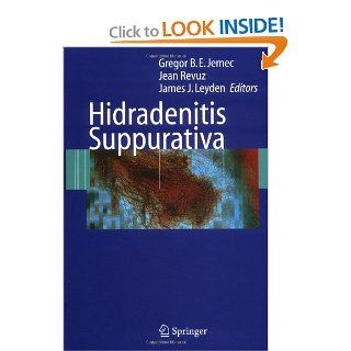 Hidradenitis Suppurativa (9783540331001) Gregor Jemec, Jean Revuz, James J. Leyden Books