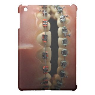 A dental model and Teeth braces iPad Mini Cases