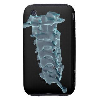 The Cervical Vertebrae 5 iPhone 3 Tough Covers