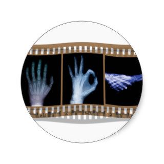 XRAY SIGN LANGUAGE FILM   HAND OK HANDSHAKE ROUND STICKER