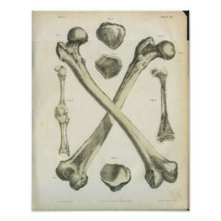 Crossed Femur Bones Anatomy Art Poster