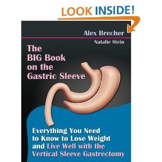 The BIG Book on the Gastric Sleeve Everything You Need To Know To Lose Weight and Live Well with the Vertical Sleeve Gastrectomy (The BIG Books on Weight Loss Surgery 2) eBook Alex Brecher, Natalie Stein Kindle Store