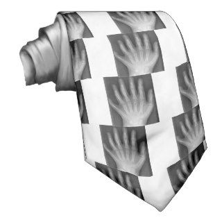 Polydactyly, Six Fingered Hand, X Ray, rarity Neck Tie