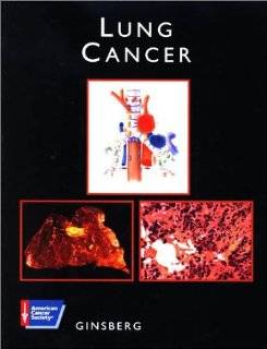 Lung Cancer with CDROM (American Cancer Society Atlas of Clinical Oncology) Robert J. Ginsberg 0001550090992 Books
