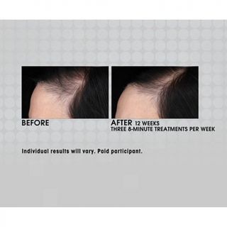 NutraStim Pro Laser Hair Comb   8095292